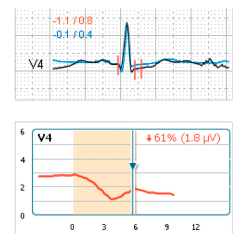 The CARDIOVIT CS-200 Excellence cardiac evaluation system for stress testing places a strong emphasis on performance.